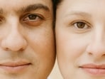 Are crow’s feet ageing you? Top treatments and prevention tips revealed Are crow’s feet ageing you? Top treatments and prevention tips revealed