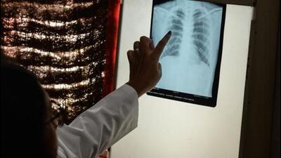 In June 2022, the health department issued a warning, stating that legal action would be taken if private hospitals did not submit the data on time. (HT Archive) In June 2022, the health department issued a warning, stating that legal action would be taken if private hospitals did not submit the data on time. (HT Archive)