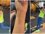 Seema Sajdeh works out at the gym after she shattered her wrist. Seema Sajdeh works out at the gym after she shattered her wrist.