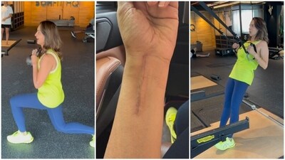 Seema Sajdeh works out at the gym after she shattered her wrist. Seema Sajdeh works out at the gym after she shattered her wrist.