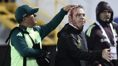 Mexico's coach, Javier Aguirre (R), is helped by an assistant after being injured in the head. (AFP) Mexico's coach, Javier Aguirre (R), is helped by an assistant after being injured in the head. (AFP)