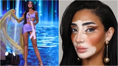 Egypt's Logina Salah, the first contestant with vitiligo, breaks barriers at Miss Universe 2024. (Instagram/@loginasalah) Egypt's Logina Salah, the first contestant with vitiligo, breaks barriers at Miss Universe 2024. (Instagram/@loginasalah)