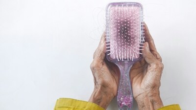 Explore common causes of hair loss and effective treatments for restoring healthy hair (Unsplash) Explore common causes of hair loss and effective treatments for restoring healthy hair (Unsplash)