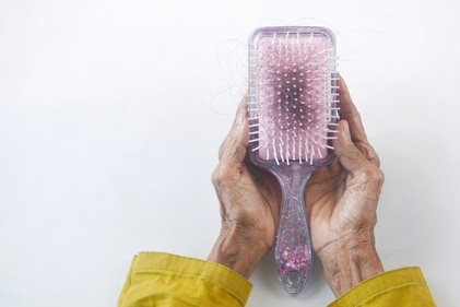 Explore common causes of hair loss and effective treatments for restoring healthy hair (Unsplash) Explore common causes of hair loss and effective treatments for restoring healthy hair (Unsplash)