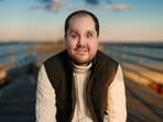 US man received a life-changing face transplant after surviving a suicide attempt.
US man received a life-changing face transplant after surviving a suicide attempt.