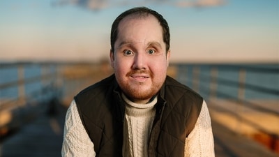 US man received a life-changing face transplant after surviving a suicide attempt. (Instagram/mayoclinic) US man received a life-changing face transplant after surviving a suicide attempt. (Instagram/mayoclinic)
