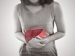 liverdisease
