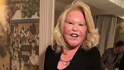 Socialite Jocelyn Wildenstein claims she has not had plastic surgery. (X/@OliLondonTV) Socialite Jocelyn Wildenstein claims she has not had plastic surgery. (X/@OliLondonTV)