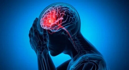 The common symptoms of stroke are trouble in walking, understanding and speaking. (Unsplash) The common symptoms of stroke are trouble in walking, understanding and speaking. (Unsplash)