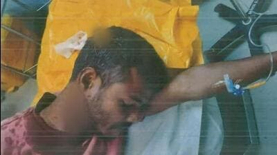 One of the labourers engaged at the Amritsar-Hoshiarpur-Una national highway project site in Amritsar, being treated at a hospital after he was injured in an attack on November 27. (HT Photo) One of the labourers engaged at the Amritsar-Hoshiarpur-Una national highway project site in Amritsar, being treated at a hospital after he was injured in an attack on November 27. (HT Photo)