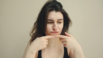 From breakouts to wrinkle-free skin: Is acne your natural anti-ageing ally? (Photo by Pexels) From breakouts to wrinkle-free skin: Is acne your natural anti-ageing ally? (Photo by Pexels)