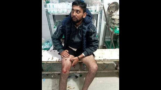 Accused Gulab Singh who was arrested by the police after exchange of fire admitted to civil hospital under police security on Monday in Ludhiana. (Hindustan Times)