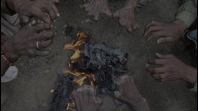 Among 54,6323 suspected cases, 1,913 tested positive for leprosy, which is 597 cases more than 2023, when 1,316 cases were reported from among 1,12,124 suspected cases, said state leprosy officer. (Pic for representation) Among 54,6323 suspected cases, 1,913 tested positive for leprosy, which is 597 cases more than 2023, when 1,316 cases were reported from among 1,12,124 suspected cases, said state leprosy officer. (Pic for representation)
