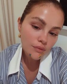 Selena Gomez has sported multi-coloured, star-shaped acne patches (Photo: Instagram)