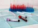 The blood test is called cell-free DNA sequencing. The blood test is called cell-free DNA sequencing.
