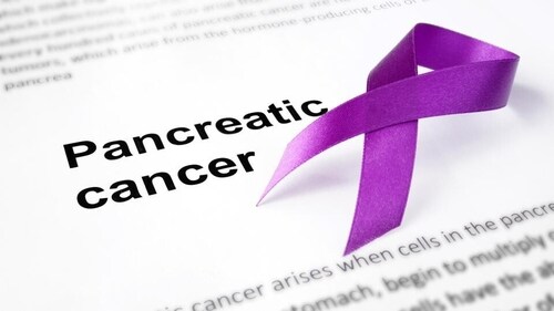 Pancreatic cancer is deadly as it goes undetected in early stage. (Shutterstock) Pancreatic cancer is deadly as it goes undetected in early stage. (Shutterstock)