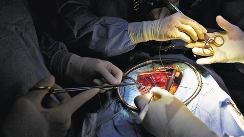Not everyone is a candidate for minimally invasive surgery.Certain health conditions may require traditional open-heart surgery. (Getty Images/Istockphoto) Not everyone is a candidate for minimally invasive surgery.Certain health conditions may require traditional open-heart surgery. (Getty Images/Istockphoto)