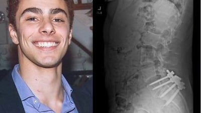 Luigi Mangione, 26, a suspect in the New York City killing of UnitedHealth executive Brian Thompson (Pic- Luigi Mangione X, Facebook) Luigi Mangione, 26, a suspect in the New York City killing of UnitedHealth executive Brian Thompson (Pic- Luigi Mangione X, Facebook)