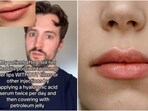 "Apply a hyaluronic acid serum twice per day and cover with petroleum jelly afterward," Mark Strom shared the hack to never having chapped lips again. "Apply a hyaluronic acid serum twice per day and cover with petroleum jelly afterward," Mark Strom shared the hack to never having chapped lips again.