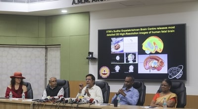 5,132 Brain sections were captured digitally using cutting-edge Brain Mapping Technology developed by Sudha Gopalakrishnan Brain Centre in the Institute. 5,132 Brain sections were captured digitally using cutting-edge Brain Mapping Technology developed by Sudha Gopalakrishnan Brain Centre in the Institute.
