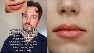 "Apply a hyaluronic acid serum twice per day and cover with petroleum jelly afterward," Mark Strom shared the hack to never having chapped lips again. (Instagram/@dermarkologist, Pexels) "Apply a hyaluronic acid serum twice per day and cover with petroleum jelly afterward," Mark Strom shared the hack to never having chapped lips again. (Instagram/@dermarkologist, Pexels)