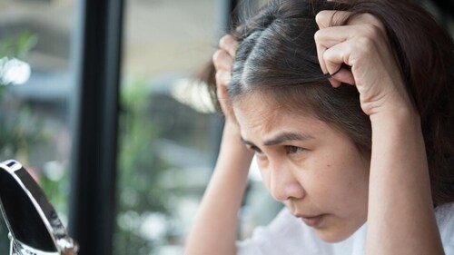 Hair loss and baldness can be managed with proper care and the right treatment. (Shutterstock) Hair loss and baldness can be managed with proper care and the right treatment. (Shutterstock)
