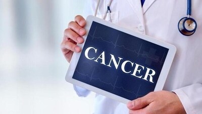 Are you missing these life-saving cancer screenings? (Photo by Shutterstock) Are you missing these life-saving cancer screenings? (Photo by Shutterstock)