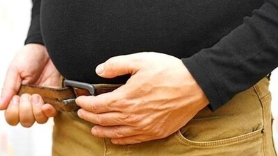 Obesity is a chronic disease that affects millions of people worldwide and has become a major health problem. (Shutterstock) Obesity is a chronic disease that affects millions of people worldwide and has become a major health problem. (Shutterstock)