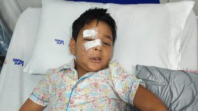 8-year-old boy severely injured in stray dog attack at Mira Road 8-year-old boy severely injured in stray dog attack at Mira Road