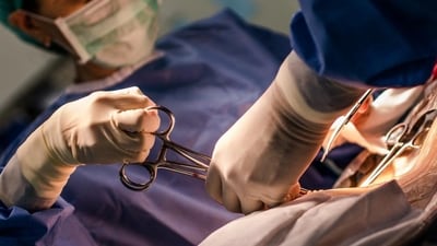 C-sections have become a norm in private healthcare due to financial incentives and convenience, Rao said. (Shutterstock) C-sections have become a norm in private healthcare due to financial incentives and convenience, Rao said. (Shutterstock)