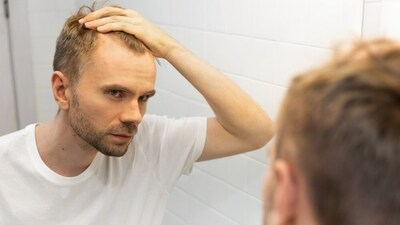 Intermittent fasting is the alternate interval of eating and fasting, according to time. A study has to say it can lead to stunted hair growth. (Shutterstock) Intermittent fasting is the alternate interval of eating and fasting, according to time. A study has to say it can lead to stunted hair growth. (Shutterstock)