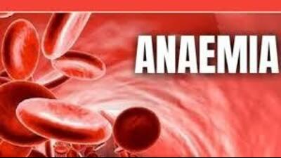 The root cause of anemia, particularly iron deficiency, exacerbates these consequences, making it a pressing health priority, they said. (HT File) The root cause of anemia, particularly iron deficiency, exacerbates these consequences, making it a pressing health priority, they said. (HT File)