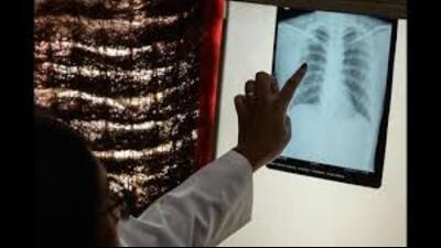 From December 7 to December 19, a total of 27,00,377 individuals were screened. (Sourced)