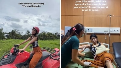 Pakistani model Arisha whose trip to Bali turned into a nightmare after her ATV bike flipped. (Instagram/@arishaanwerr) Pakistani model Arisha whose trip to Bali turned into a nightmare after her ATV bike flipped. (Instagram/@arishaanwerr)