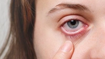 Discover how eye symptoms can indicate underlying health problems. (Freepik) Discover how eye symptoms can indicate underlying health problems. (Freepik)