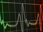 A member of the cleaning staff at the civic-run Shatabdi Hospital in Govandi administered an echocardiogram (ECG) to a patient on December 29 A member of the cleaning staff at the civic-run Shatabdi Hospital in Govandi administered an echocardiogram (ECG) to a patient on December 29