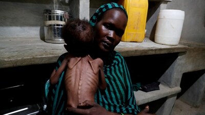 Robaika Peter, 25, holds her severely malnourished child at the paediatric ward of the Mother of Mercy Hospital in Gidel, South Kordofan, Sudan June 25, 2024. (REUTERS)