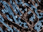 There have been 61 cases of bird flu in the US since April 2024