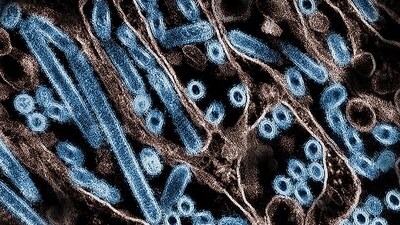 There have been 61 cases of bird flu in the US since April 2024 (AFP) There have been 61 cases of bird flu in the US since April 2024 (AFP)