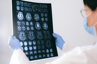 The researchers studied brain tissue samples from multiple regions, including hippocampus and entorhinal cortex, the areas typically most affected by Alzheimer’s disease. (Pexels) The researchers studied brain tissue samples from multiple regions, including hippocampus and entorhinal cortex, the areas typically most affected by Alzheimer’s disease. (Pexels)