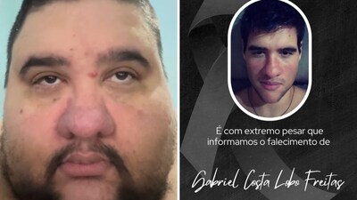 Gabriel Freitas died after he regained his weight following his staggering weight-loss journey. (Instagram/mupgabriel) Gabriel Freitas died after he regained his weight following his staggering weight-loss journey. (Instagram/mupgabriel)