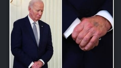 Biden's health has come back into the spotlight after The Wall Street Journal published an article on December 19 on how his staff managed with a “diminished” president during his term in the office. (X)