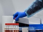 HMPV, first identified in 2001 by researchers in the Netherlands, is a significant cause of acute respiratory infections, according to the American Lung Association HMPV, first identified in 2001 by researchers in the Netherlands, is a significant cause of acute respiratory infections, according to the American Lung Association