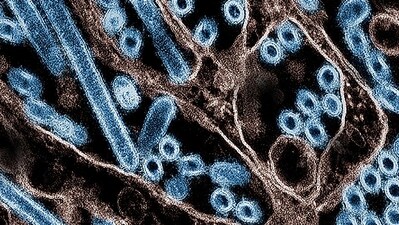 An individual in Louisiana who was hospitalised due to severe respiratory symptoms was the first documented bird flu fatality in the United States. (AFP) An individual in Louisiana who was hospitalised due to severe respiratory symptoms was the first documented bird flu fatality in the United States. (AFP)