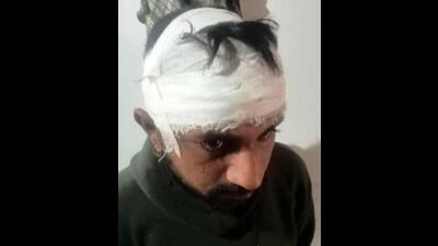 Victim Jasvir Singh who was attacked near Bagga Kalan village. (HT Photo) Victim Jasvir Singh who was attacked near Bagga Kalan village. (HT Photo)