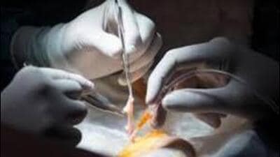 Currently, all organ transplants in Chandigarh are conducted exclusively at PGIMER, making it the city’s central hub for these life-saving procedures. (Getty image) Currently, all organ transplants in Chandigarh are conducted exclusively at PGIMER, making it the city’s central hub for these life-saving procedures. (Getty image)