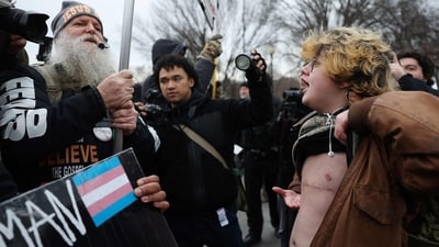 Rusty Budd, 18, lifts his shirt to show counter protestors his top surgery scars during the “People's March on Washington”. Activists were rallying in opposition to the incoming Trump administration's policy objectives two days before the presidential inauguration. (Getty Images via AFP) Rusty Budd, 18, lifts his shirt to show counter protestors his top surgery scars during the “People's March on Washington”. Activists were rallying in opposition to the incoming Trump administration's policy objectives two days before the presidential inauguration. (Getty Images via AFP)
