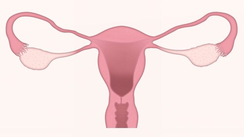 The rise in cancer incidence among women under 50 has surged to 82% higher than men. (Pixabay) The rise in cancer incidence among women under 50 has surged to 82% higher than men. (Pixabay)