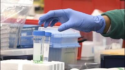 Samples of two suspected Guillain-Barre Syndrome (GBS) patients admitted at Poona Hospital tested positive for bacterial infection Campylobacter jejuni, on Tuesday. (AP (PIC FOR REPRESENTATION)) Samples of two suspected Guillain-Barre Syndrome (GBS) patients admitted at Poona Hospital tested positive for bacterial infection Campylobacter jejuni, on Tuesday. (AP (PIC FOR REPRESENTATION))