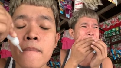A man applied superglue to his lips for fun, but soon panicked when he couldn’t open his mouth. (Instagram/badis_tv) A man applied superglue to his lips for fun, but soon panicked when he couldn’t open his mouth. (Instagram/badis_tv)
